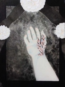 exid119929wid104362 / 腱鞘炎